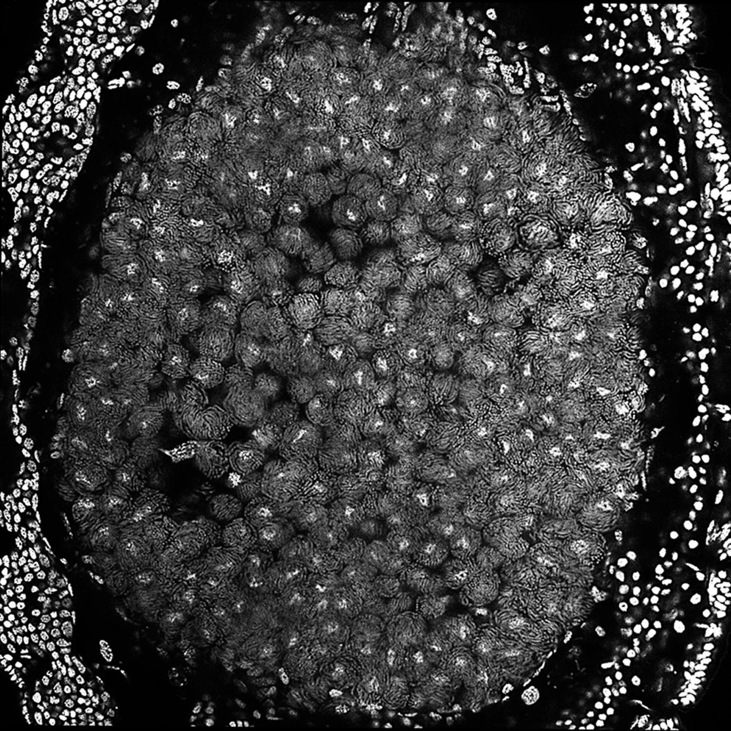 Micrograph of bacteriocytes in the gut of a larval carpenter ant.