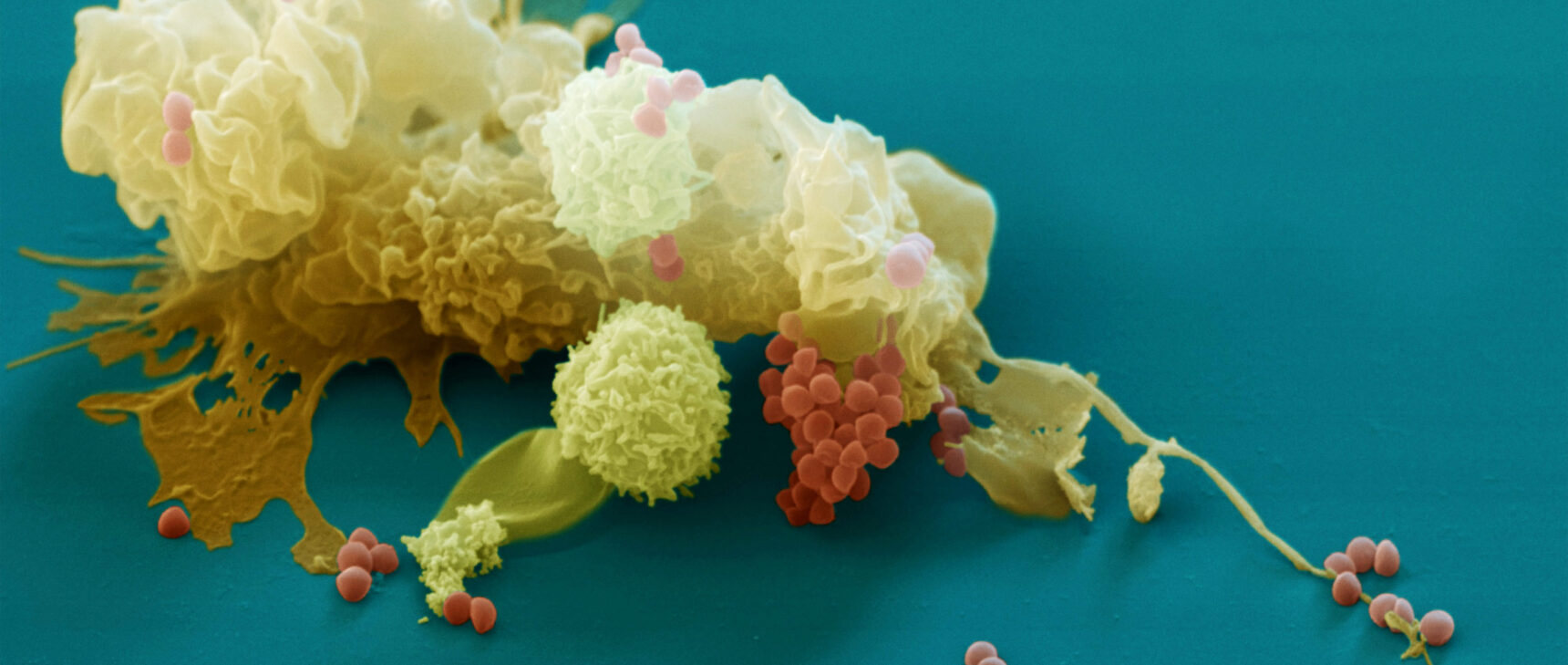 A false-colored scanning electron micrograph of a macrophage.