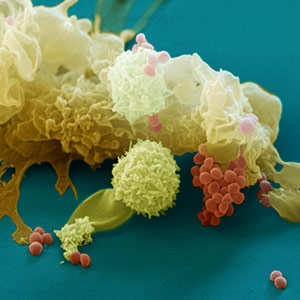 A false-colored scanning electron micrograph of a macrophage.