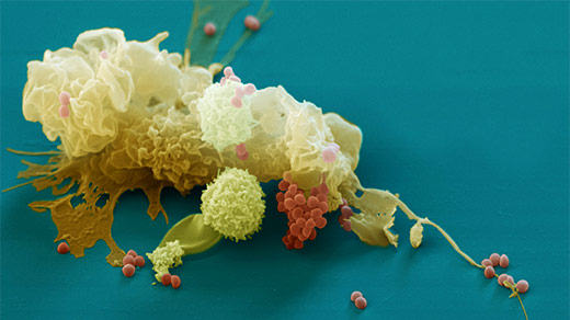 A false-colored scanning electron micrograph of a macrophage.