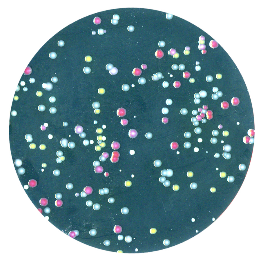 Magnified view of bacteria growing on an agar plate.