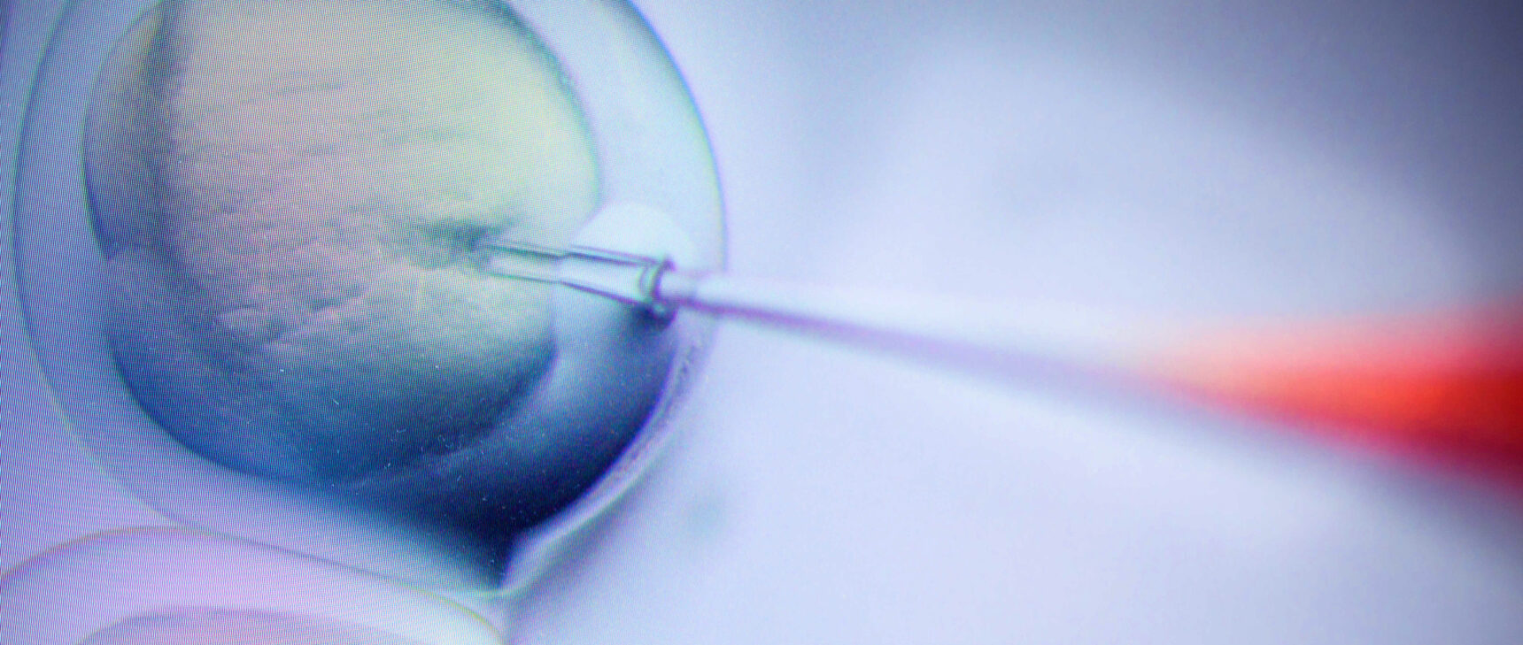 Cells being injected with a microneedle.