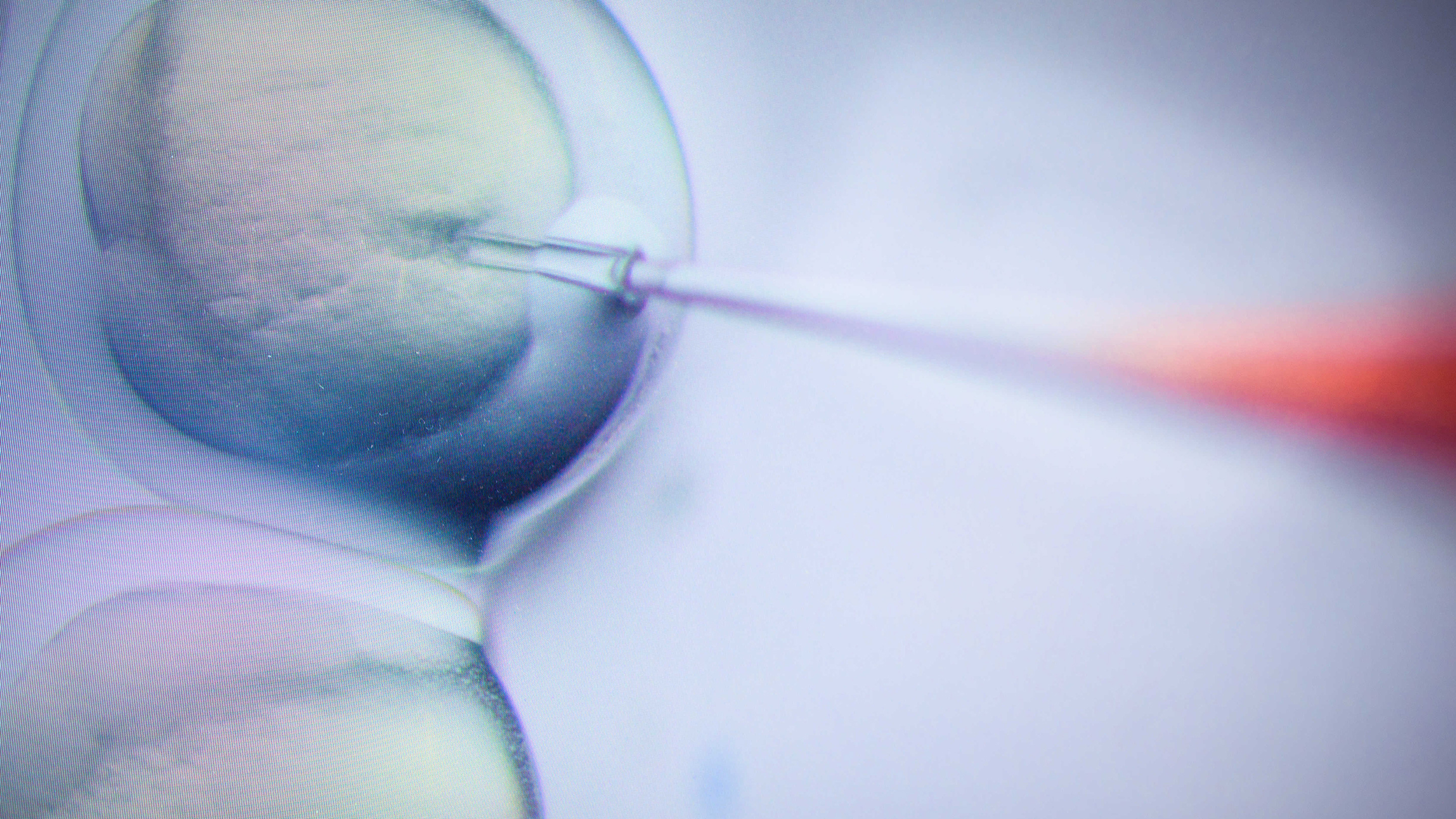 Cells being injected with a microneedle.