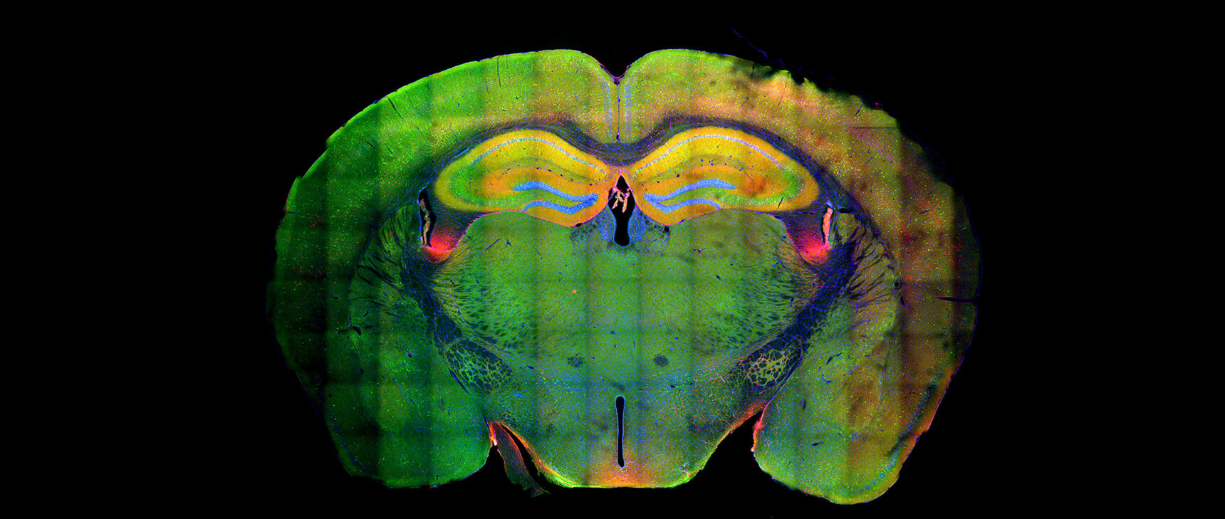 Fluorescent cross-section of a mouse’s brain.