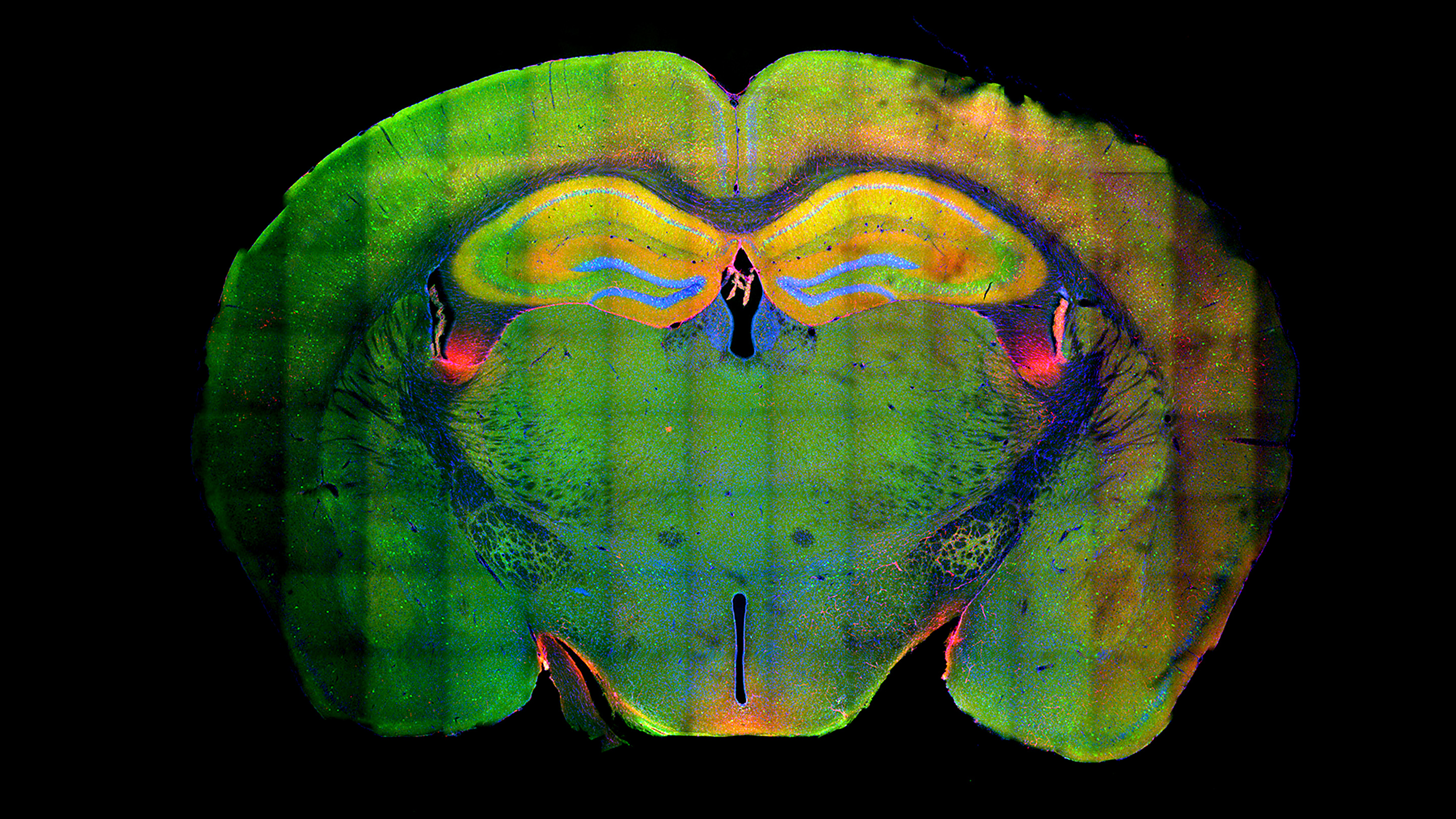 Fluorescent cross-section of a mouse’s brain.