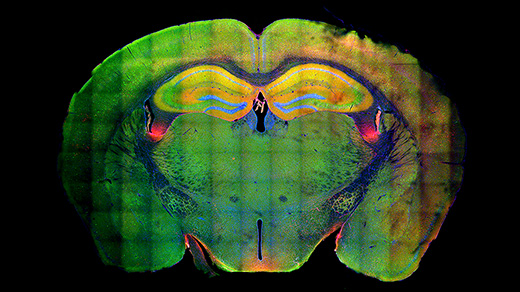 Fluorescent cross-section of a mouse’s brain.