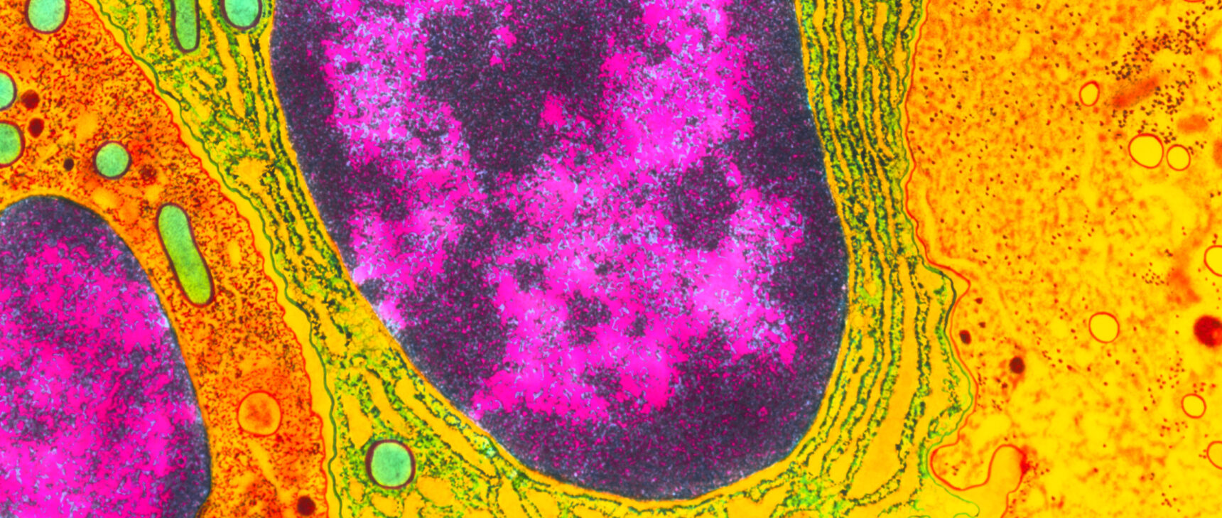 Colorized micrograph of a cell’s nucleus, showing euchromatin and heterochromatin.