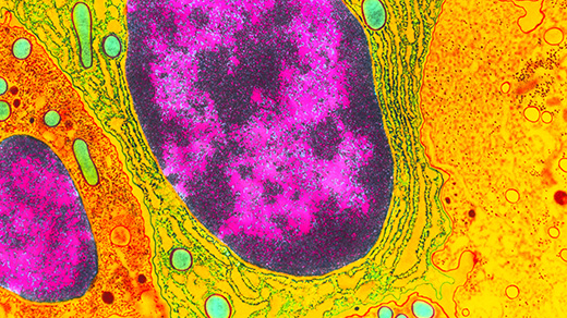 Colorized micrograph of a cell’s nucleus, showing euchromatin and heterochromatin.