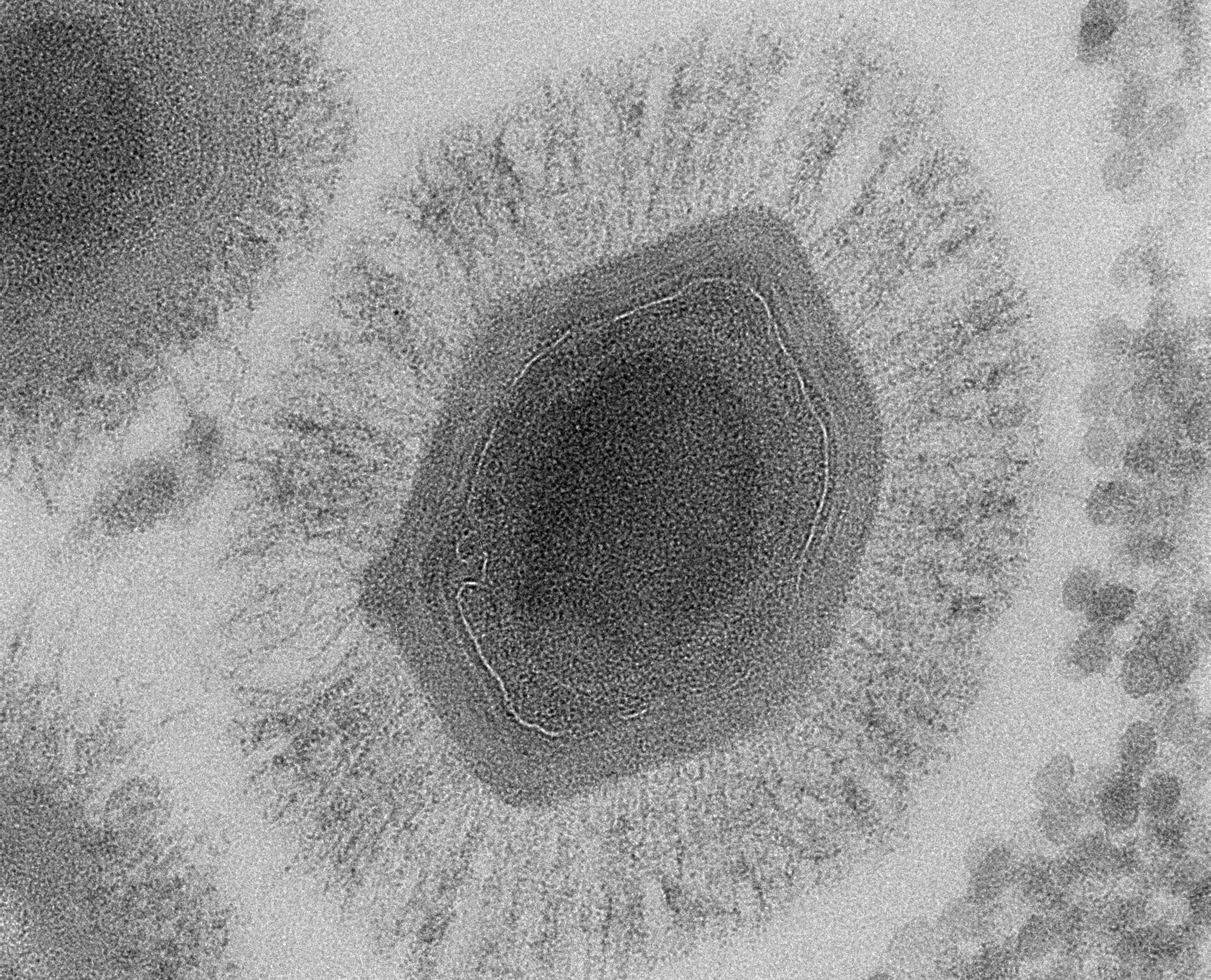 Electron micrograph of a mimivirus.