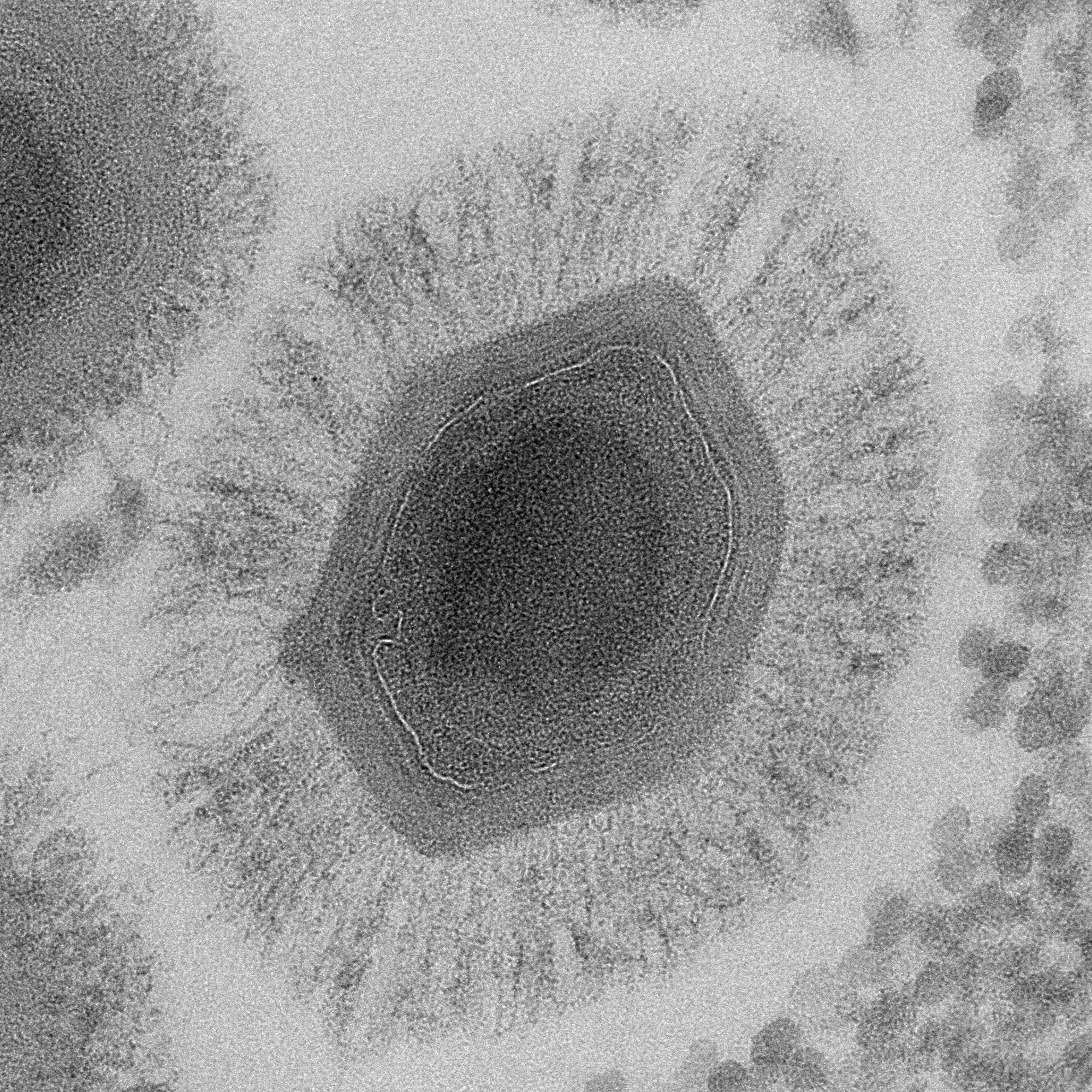 Electron micrograph of a mimivirus.