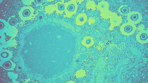 Electron micrograph showing a viral factory and new viral particles inside a cell.