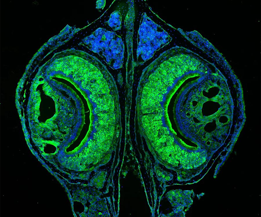 An immunofluorescent stained section of the vomeronasal organ of a rodent.