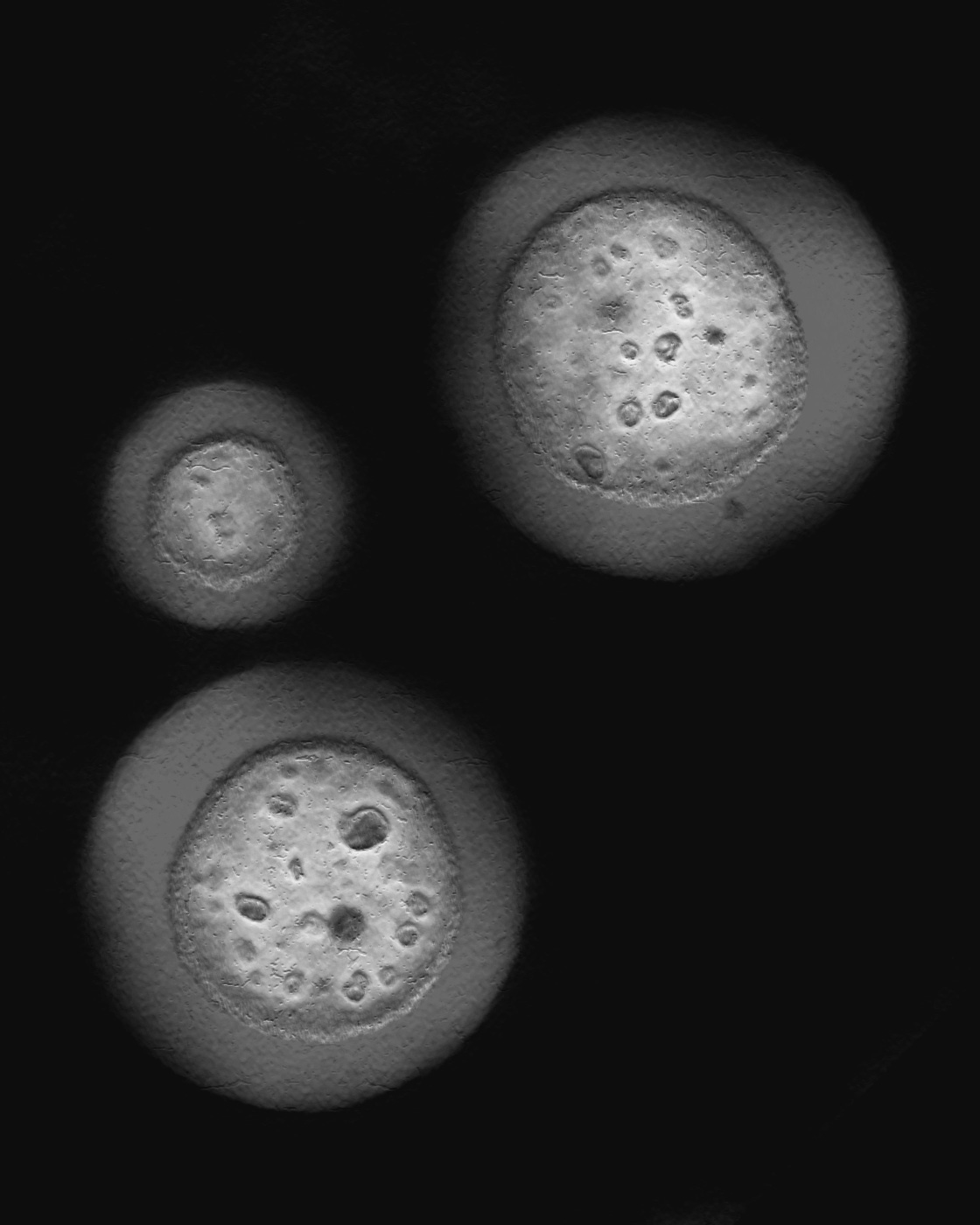 Stained nucleoli from frog cells, showing subcompartments within the condensate.