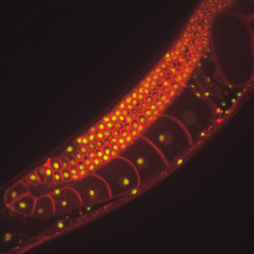 Nucleoli appear as green blobs in the cells of stained C. elegans tissue.