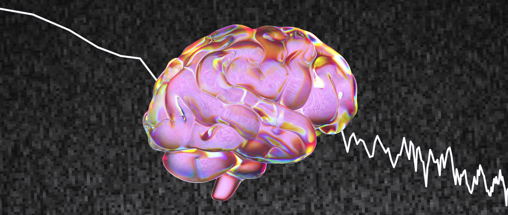 An illustration of a human brain against “pink noise” static.