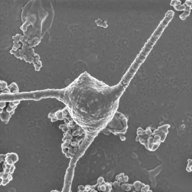 A pair of micrographs showing an archaeal cell and some proteobacteria.