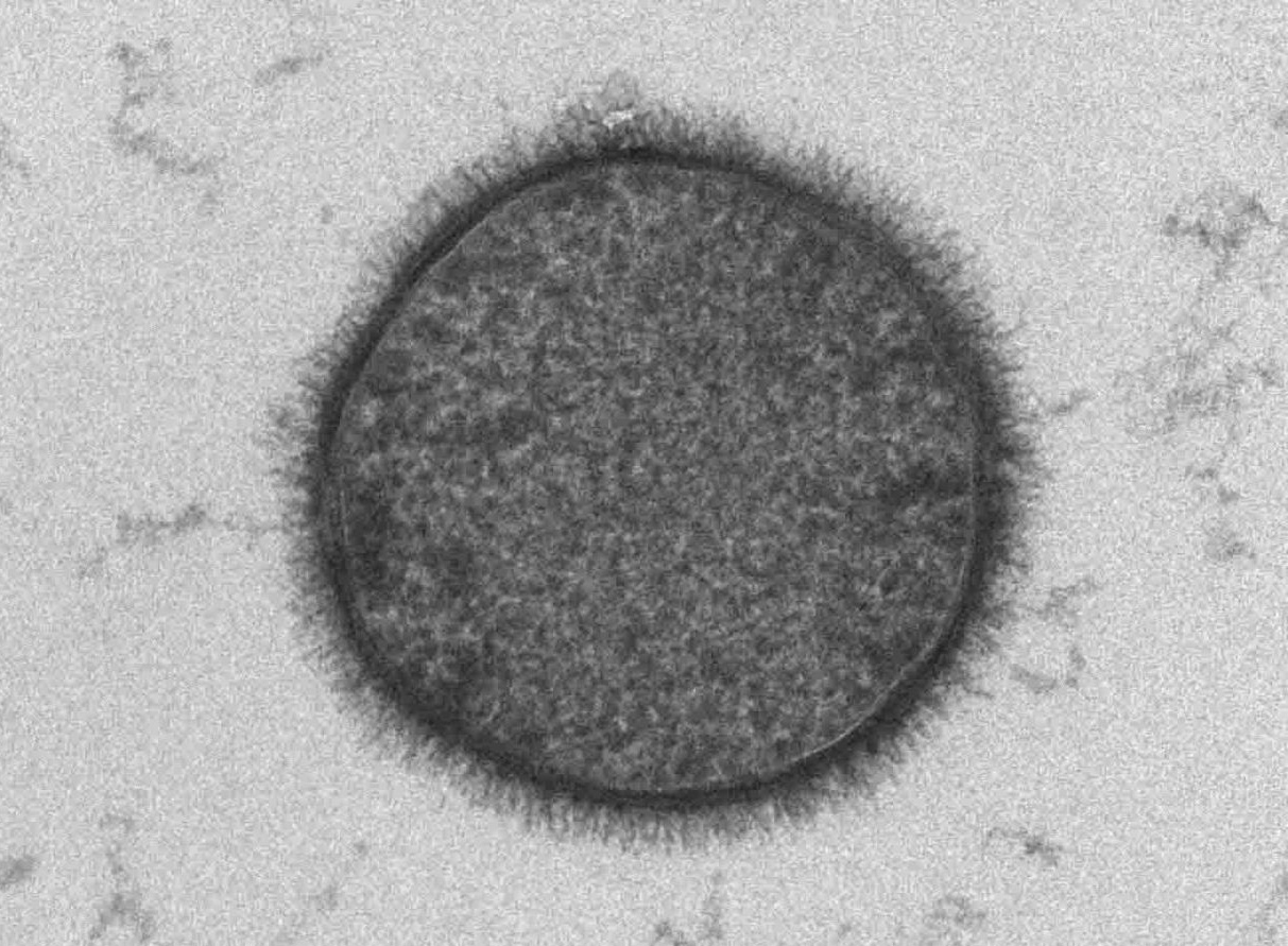 Electron micrograph showing the fuzzy glycan coating on the surface of Bacillus subtilis.