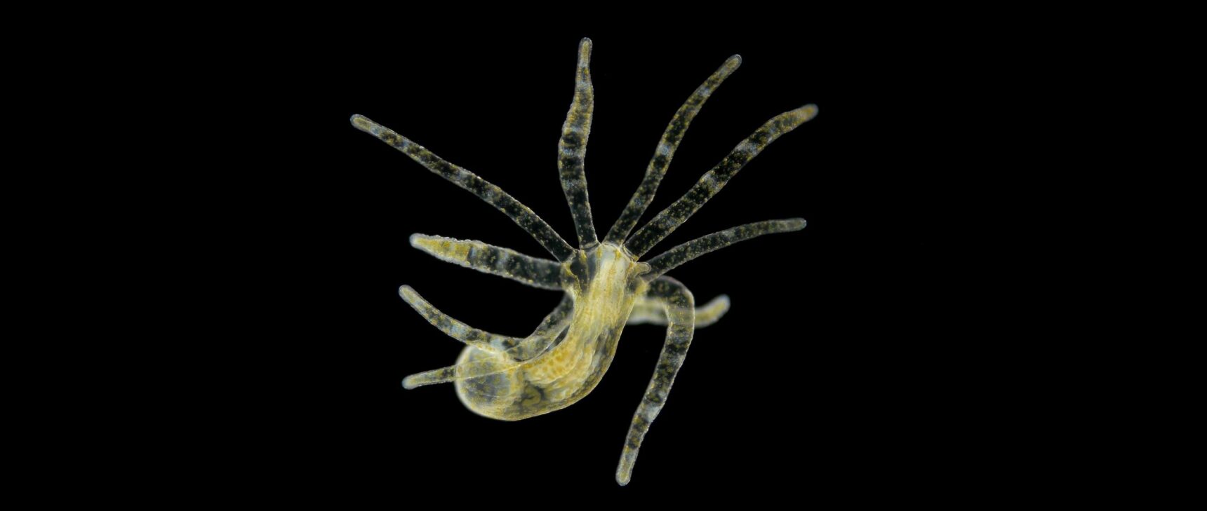 Video of a hydra moving against a dark background.