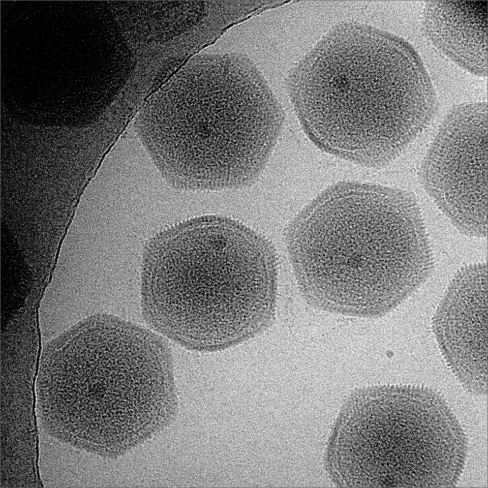 Electron micrograph of Marseilleviridae viruses.