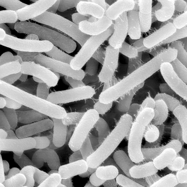 A pair of micrographs showing an archaeal cell and some proteobacteria.