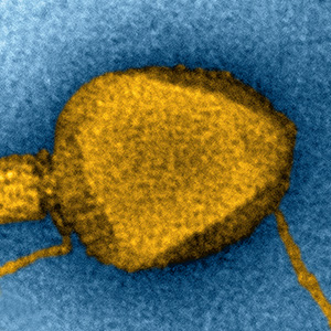 Electron microscopy of T4 bacteriophages.