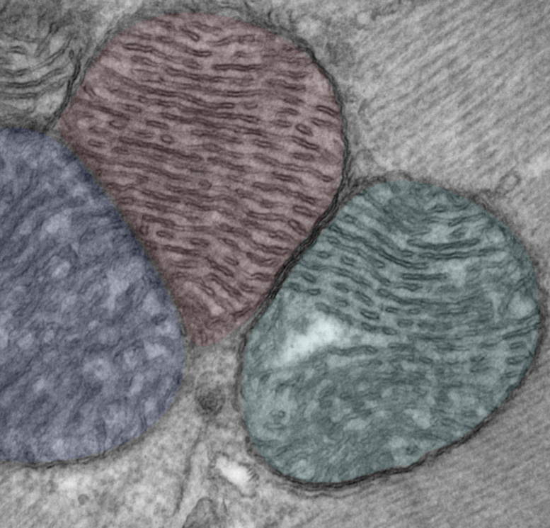 Electron micrograph showing the cristae in adjacent mitochondria lined up.