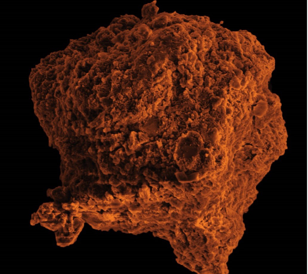 a micrograph image of an orange blob