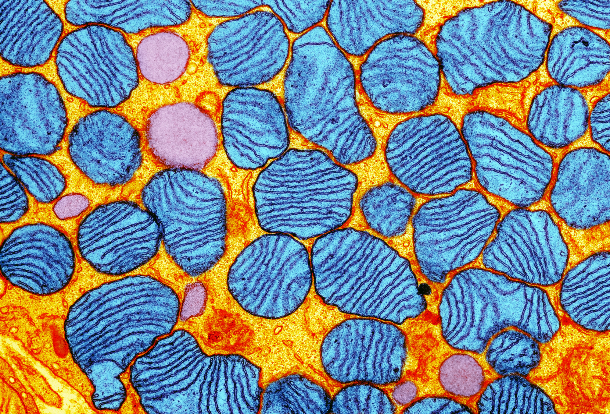 In this colored electron micrograph, mitochondria (blue) float within the cytoplasm of an adipocyte (fat cell).