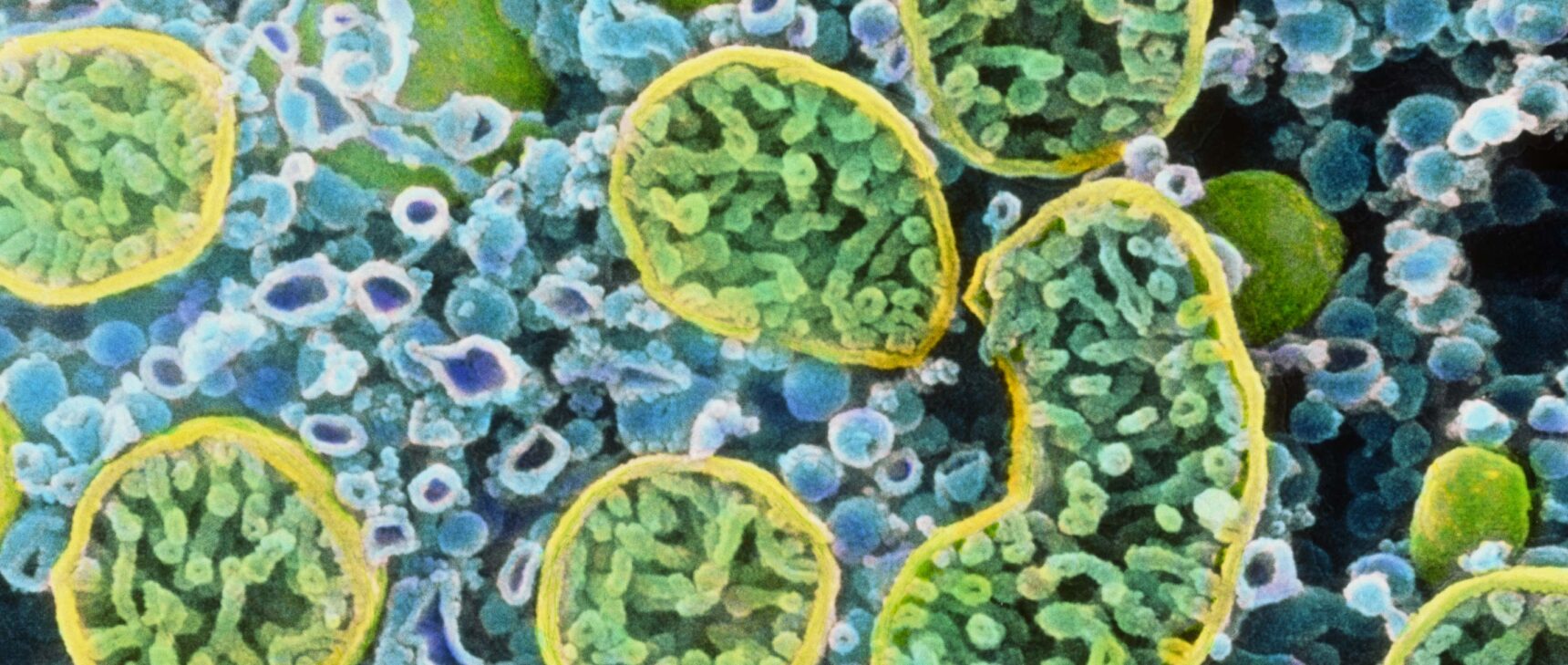 False-colored electron micrograph of an ovarian cell, showing cross-sections of mitochondria.