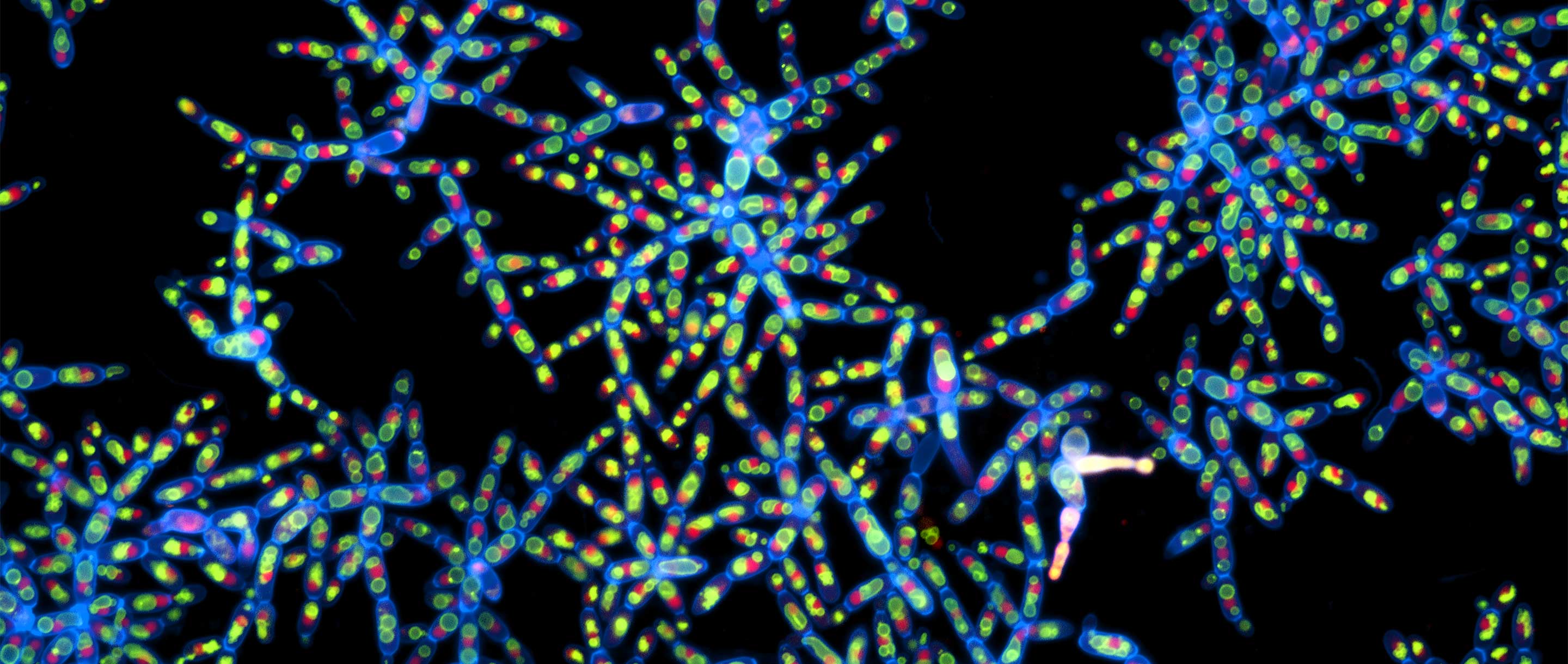 Micrograph of snowflake yeast.