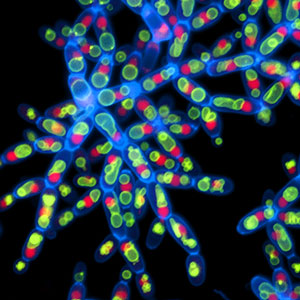 Micrograph of snowflake yeast.