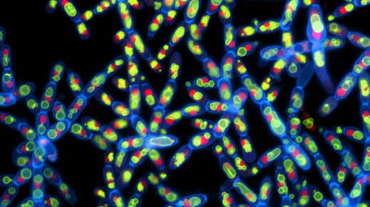 Micrograph of snowflake yeast.