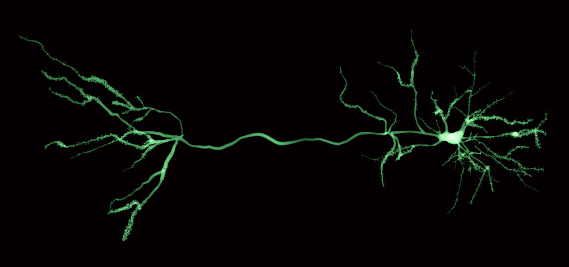 An isolated pyramidal neuron from the brain.