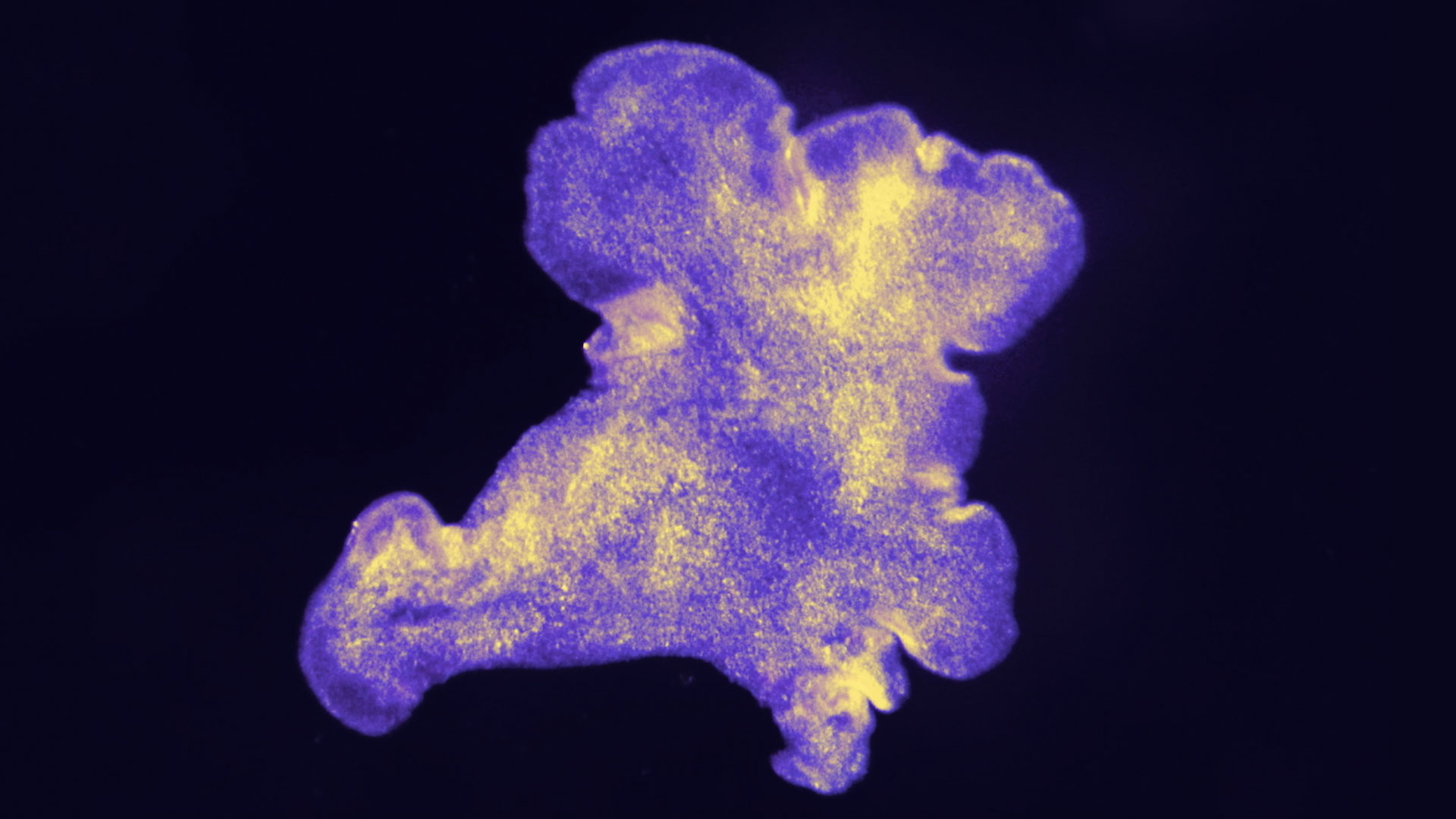 image of purple trichoplax organism against a black background