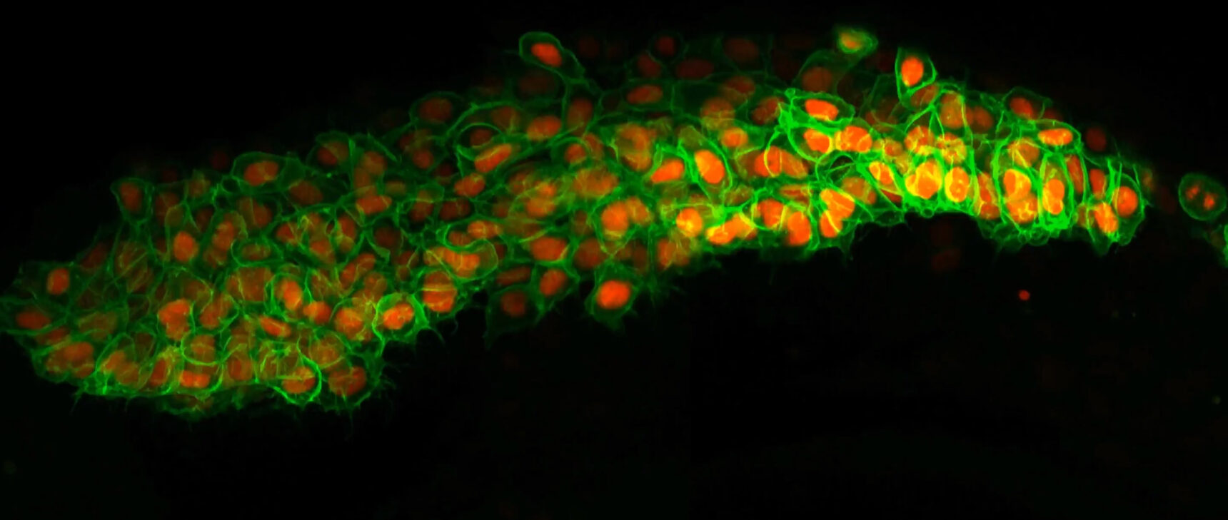 Video of fluorescent neural crest cells migrating through zebra fish tissues.