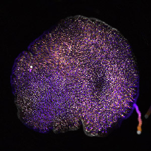 Image of Trichoplax adhaerens moving against a black background.