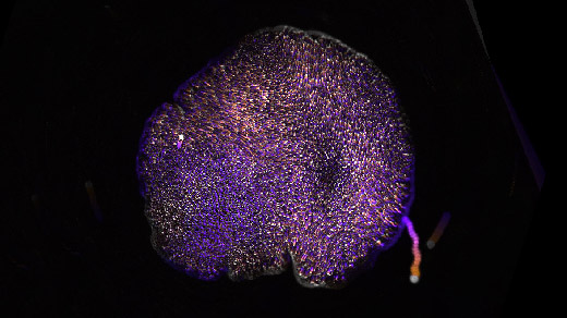 Image of Trichoplax adhaerens moving against a black background.