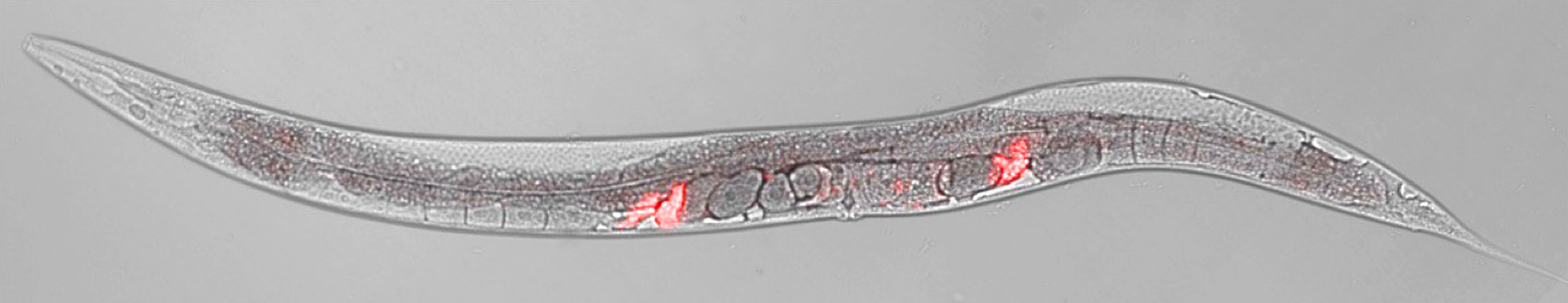 Microscopy of a C. elegans roundworm with glowing molecules marking its sperm.