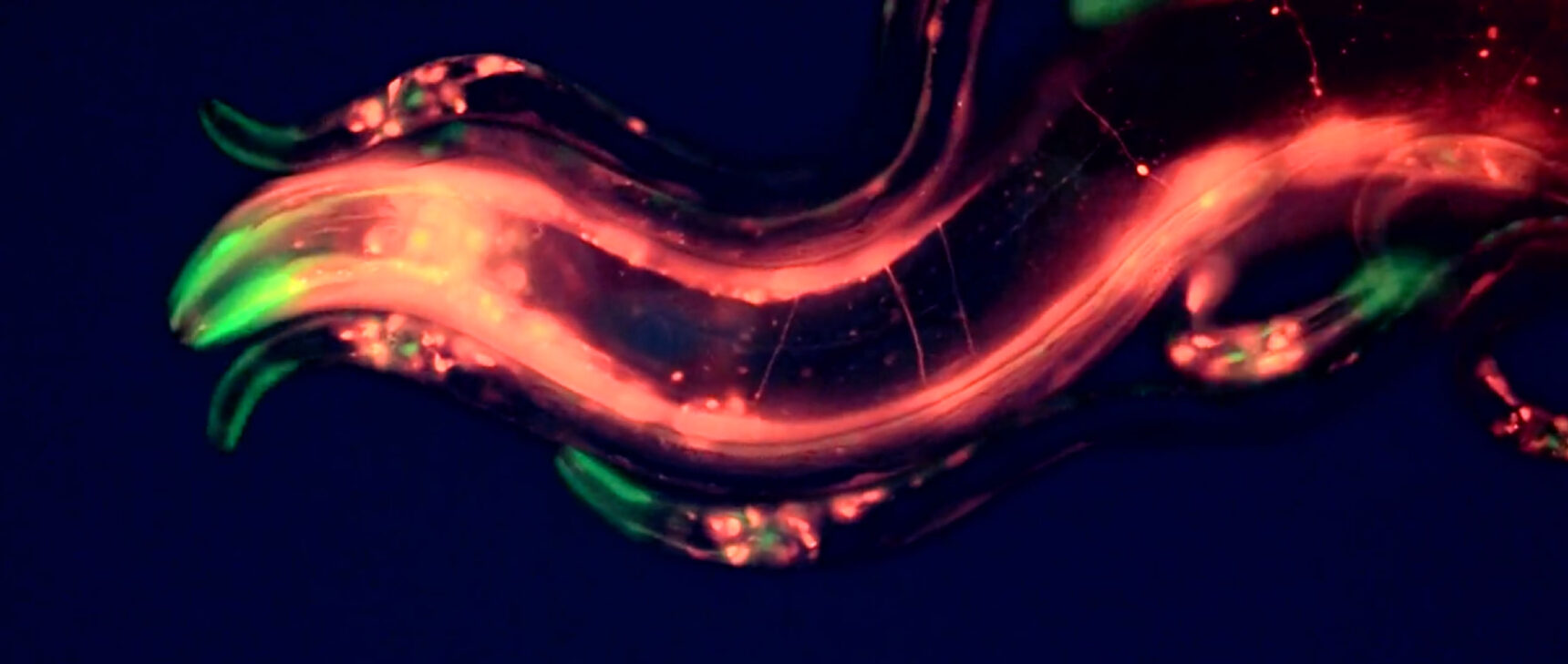 Video microscopy of a large C. elegans roundworm flanked by several much smaller ones.