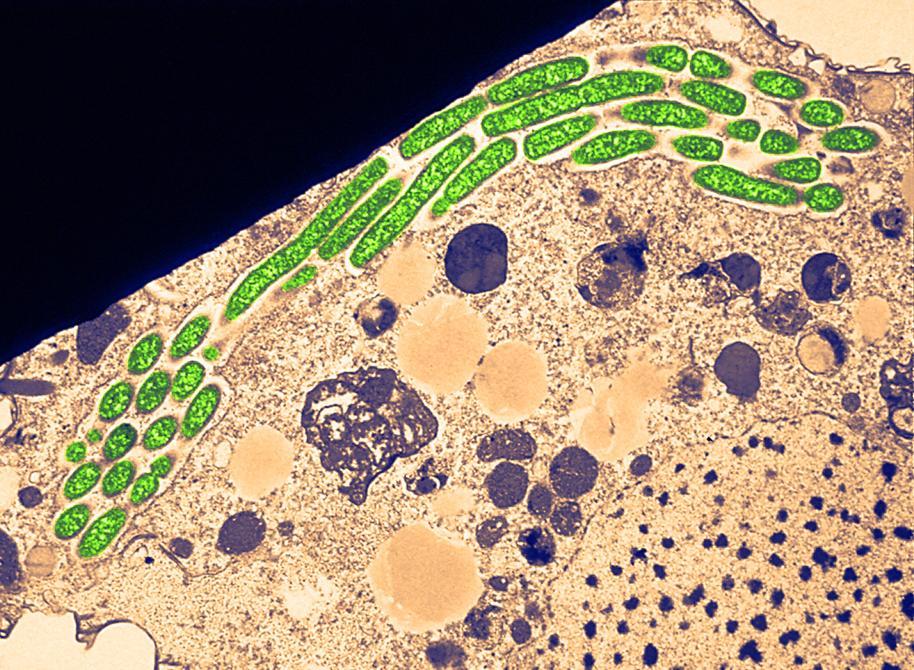 Micrograph of Legionella bacteria inside a protozoan.