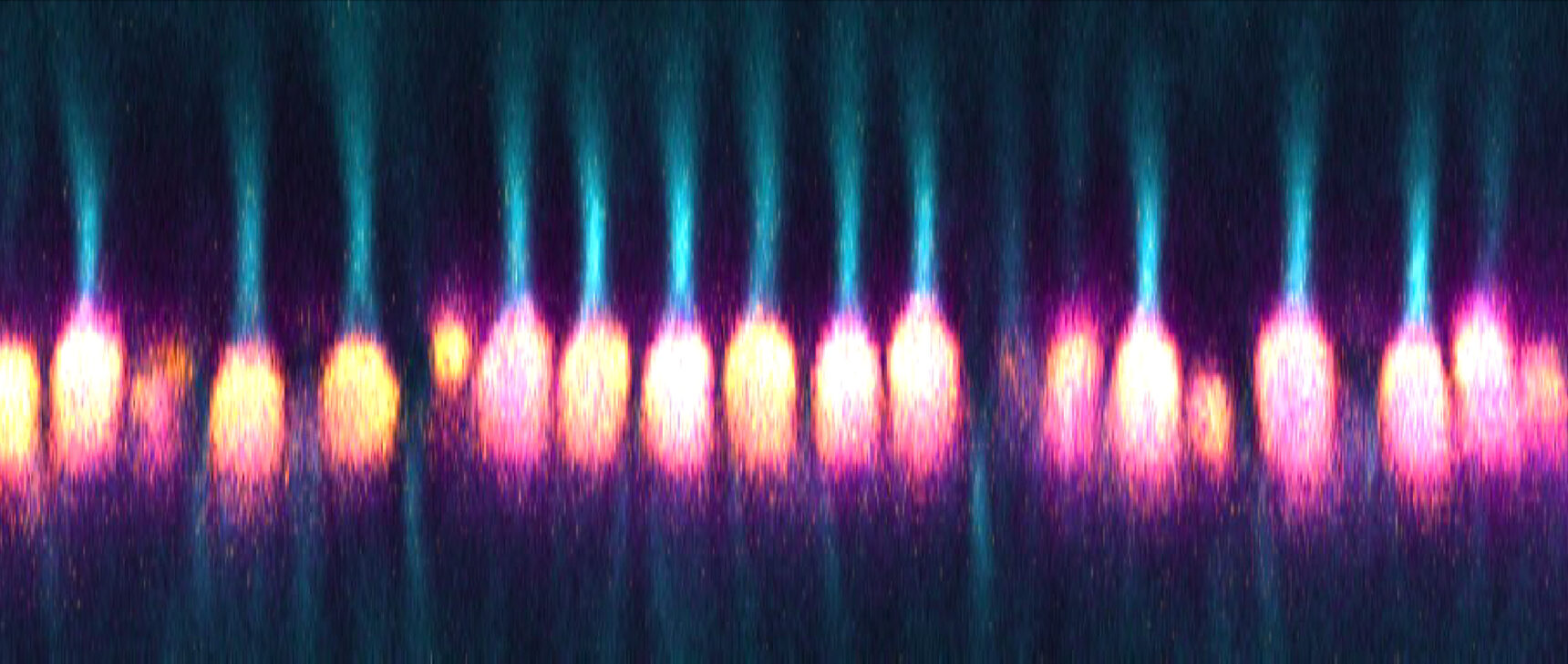 Simulated microscopy image of light shining through mitochondrial bundles and emerging as tight beams.