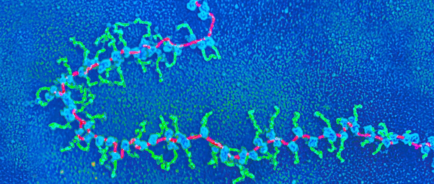 Colorized transmission electron micrograph of a polyribosome.