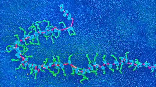 Colorized transmission electron micrograph of a polyribosome.