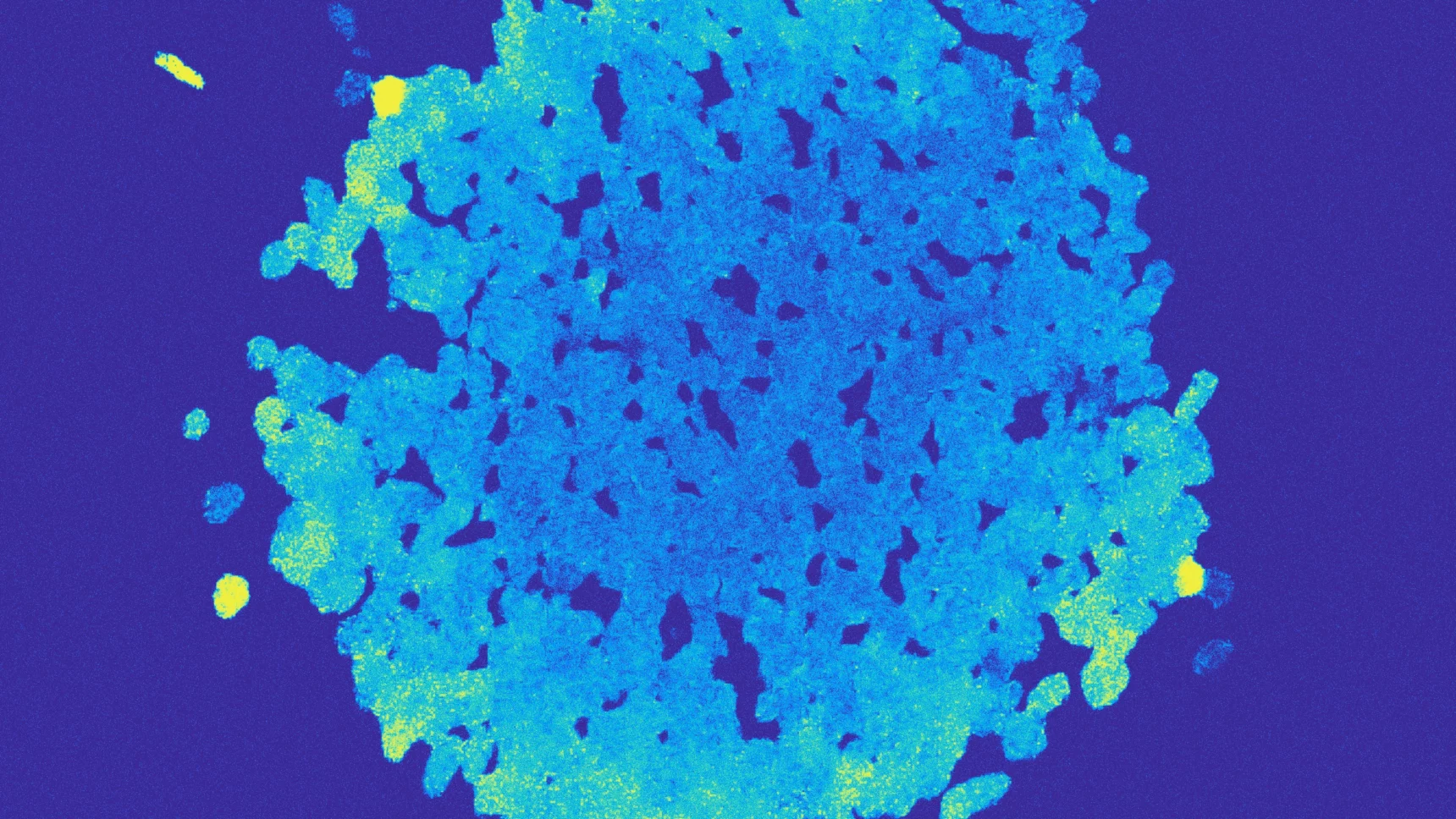 An artificially colored cross section through one of the Vibrio orbs.