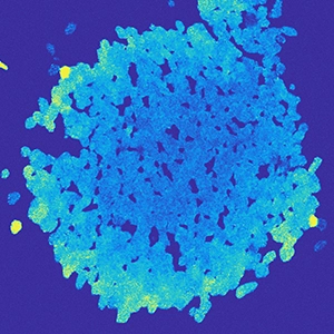 An artificially colored cross section through one of the Vibrio orbs.