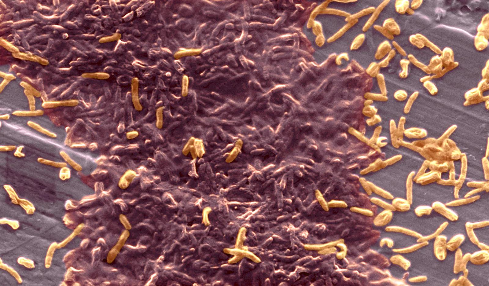 Bacteria growing as a biofilm.