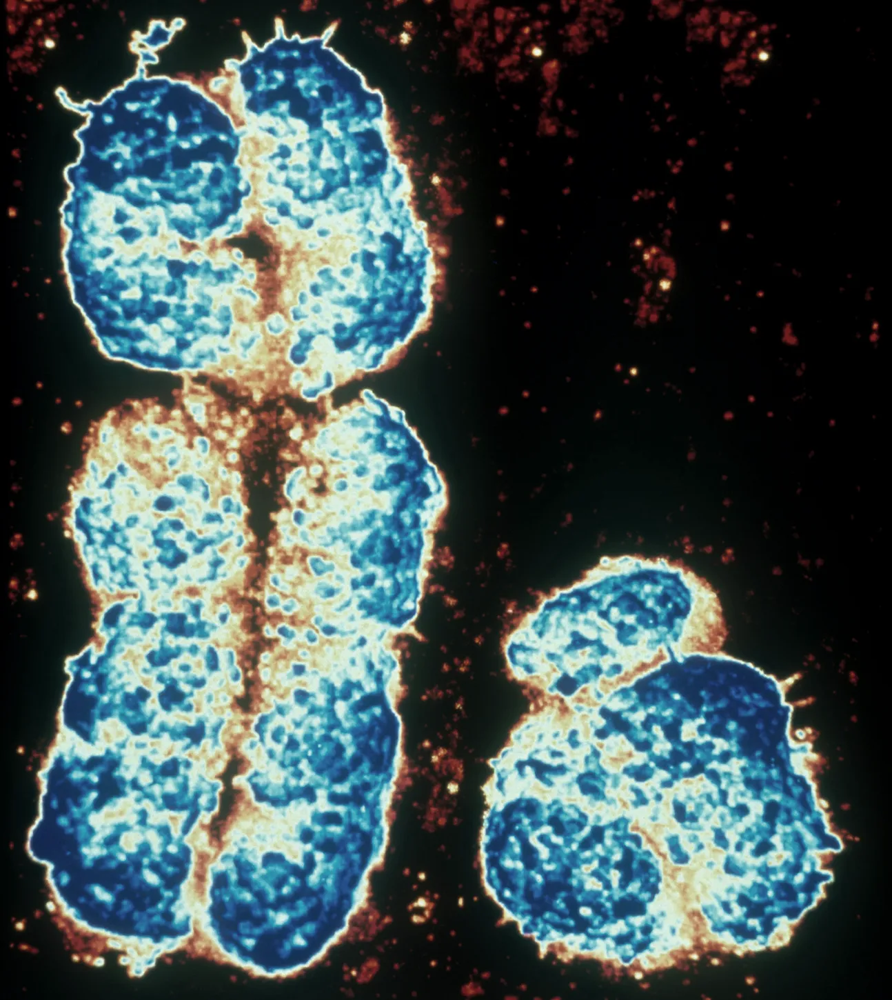 micrograph of x and y sister chromatids side by side, the y chromosomes are about 1/3 the size as the x