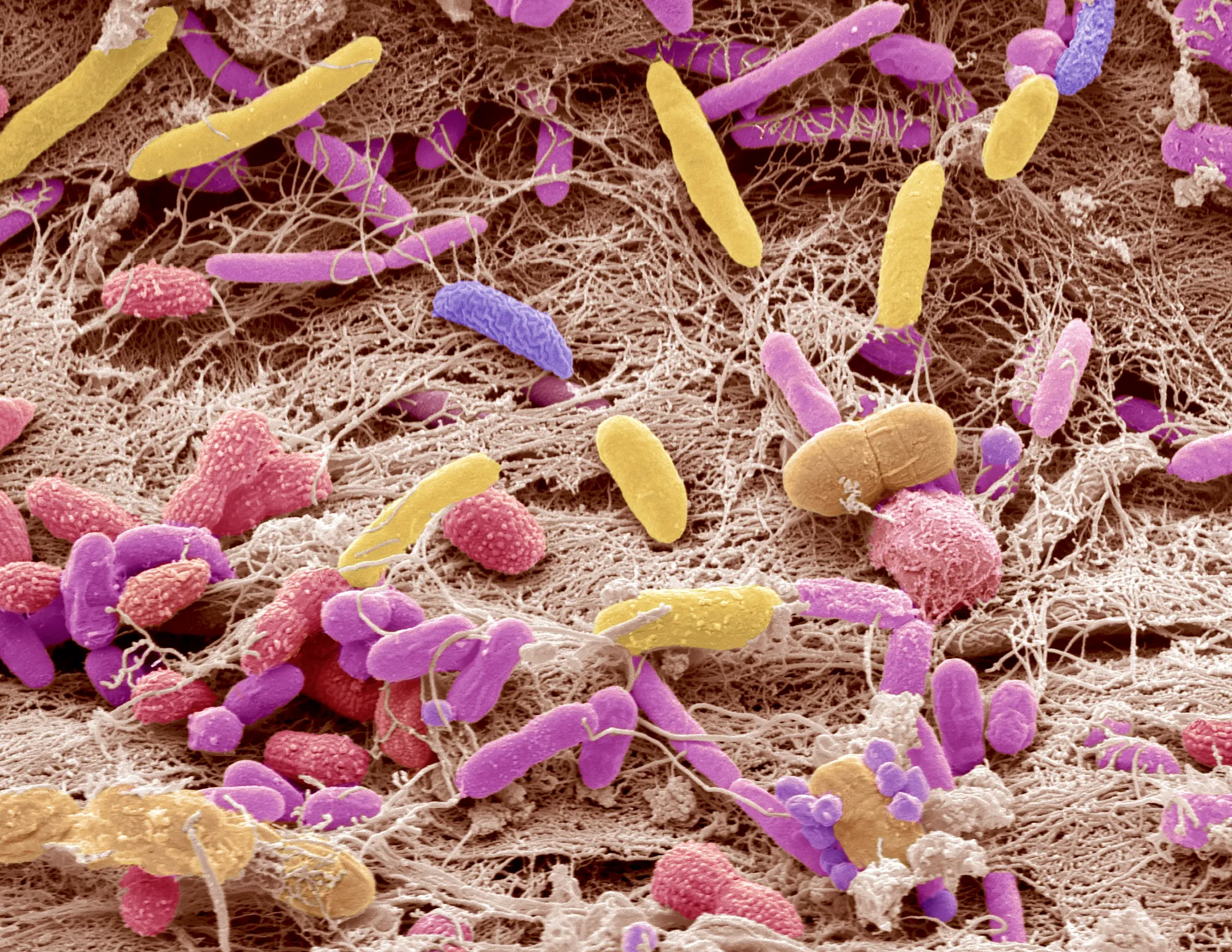 Artificially colored bacteria in a microbiome.