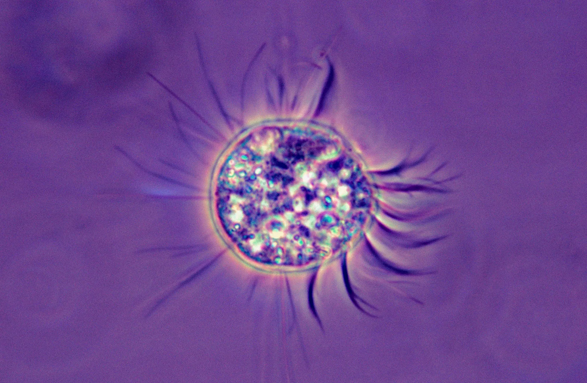 Micrograph of a single Halteria ciliate.