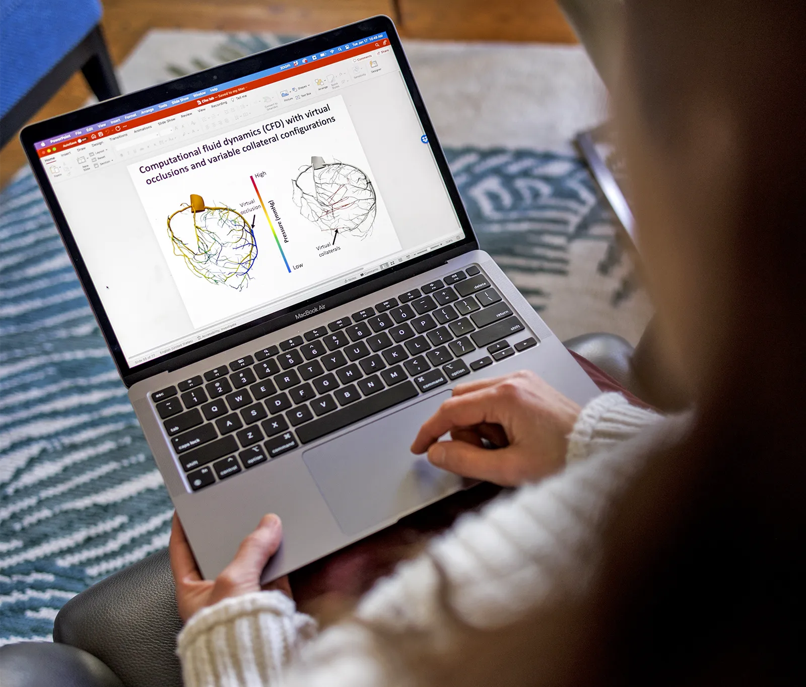 A laptop in Red Horse’s lap, displaying a technical image of a heart from a paper related to her work.